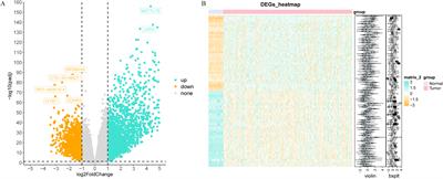 Investigation of risk signatures associated with anoikis in thyroid cancer through integrated transcriptome and Mendelian randomization analysis